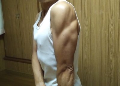 上腕三頭筋