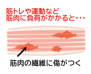 筋肉痛しくみ