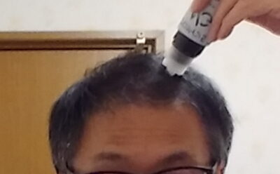 発毛剤アロゲイン使用の様子